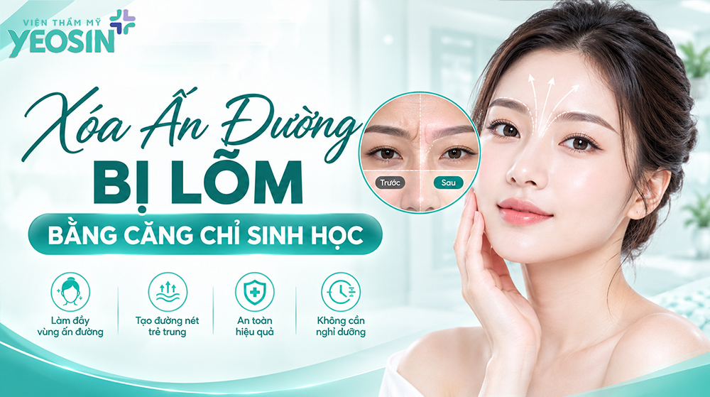 Ấn đường bị lõm là gì? Cách khắc phục ấn đường lõm sâu 16 Cách trị án đường bị lõm bằng công nghệ căng chỉ sinh học