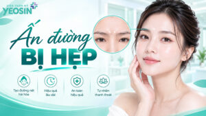 Ấn đường hẹp: Giải mã tướng số người có ấn đường bị hẹp