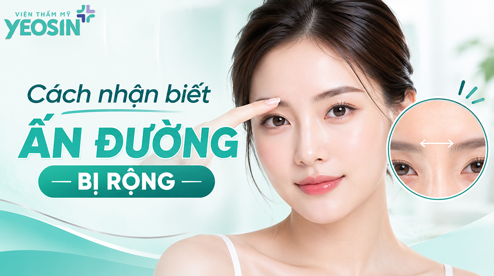 Khám phá bí ẩn của ấn đường rộng trong tướng số 6 Cách nhận biết ấn đường bị rộng