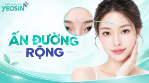ấn đường rộng