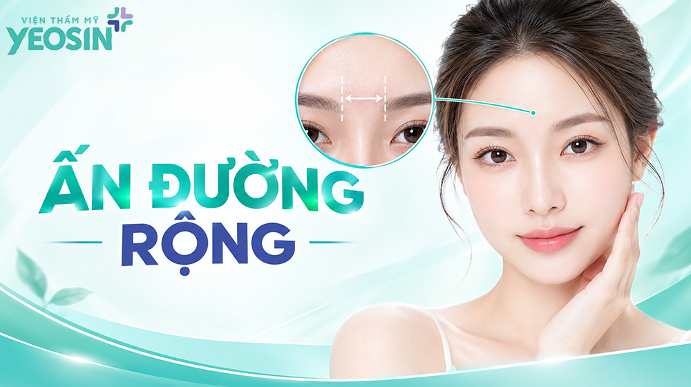 ấn đường rộng