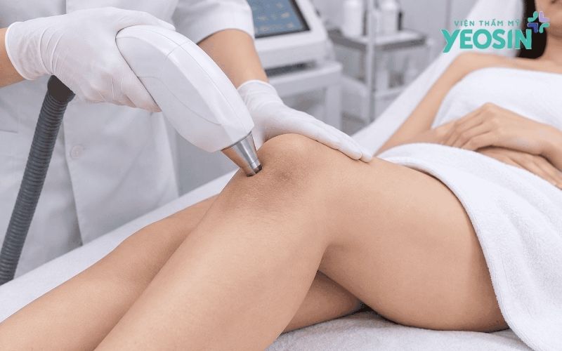Thâm đầu gối: Nguyên nhân và cách cải thiện làn da 6 Phương pháp Bio Skin trị thâm đầu gối tại Yeosin