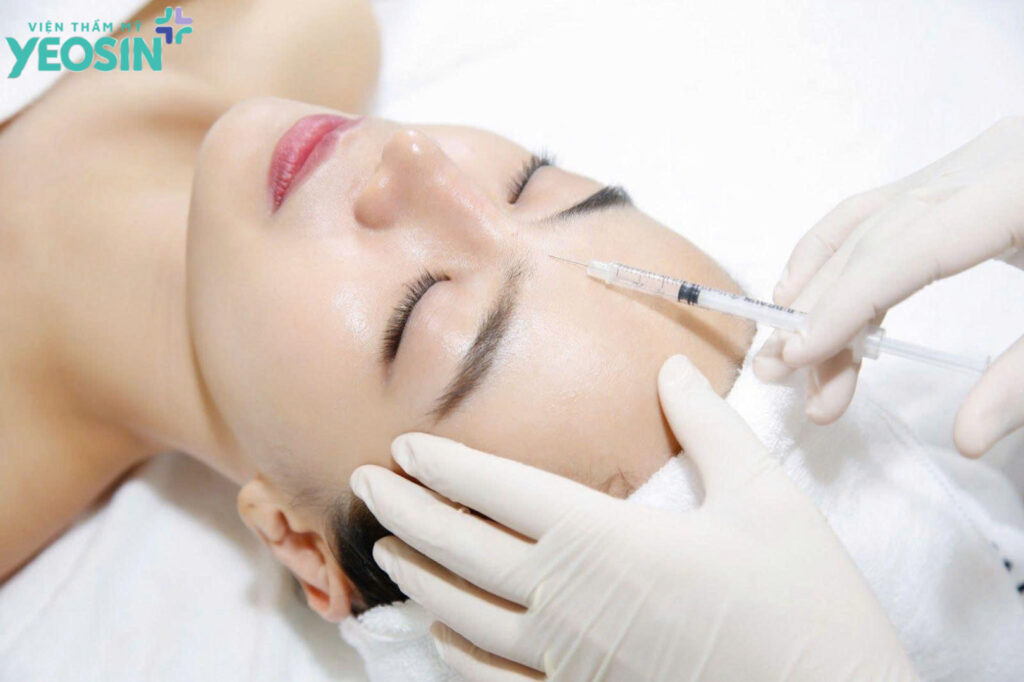 Xóa nhăn cau mày - Xóa nếp nhăn cau mày bằng tiêm botox 14 Cơ chế hoạt động của botox xóa nhăn cau mày