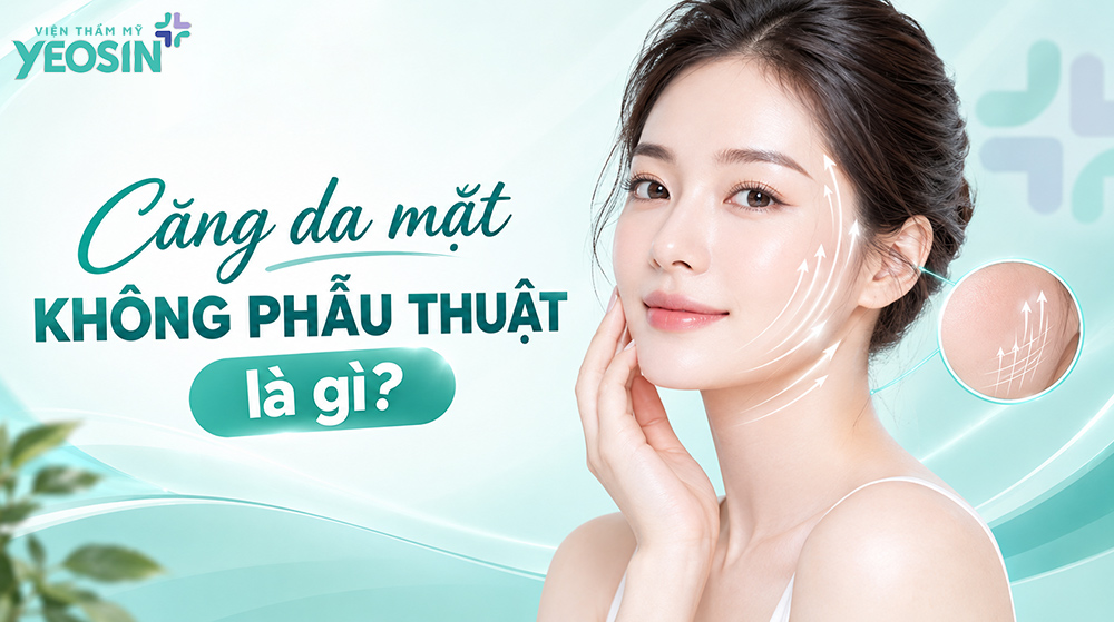 Căng da mặt không phẫu thuật là gì?