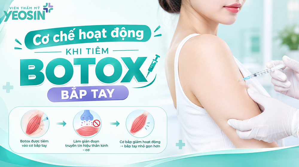 Tiêm botox bắp tay - Giải pháp giảm mỡ thon gọn bắp tay 8 Cơ chế hoạt động khi tiêm botox giảm bắp tay