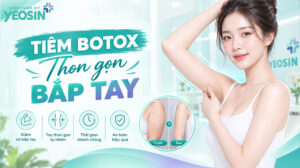 Tiêm botox bắp tay - Giải pháp giảm mỡ thon gọn bắp tay