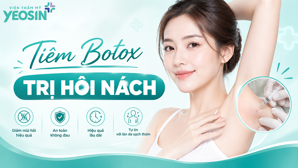Tiêm botox trị hôi nách và những điều cần biết khi botox nách