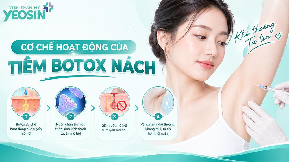 Tiêm botox trị hôi nách và những điều cần biết khi botox nách 9 Cơ chế hoạt động của tiêm botox nách