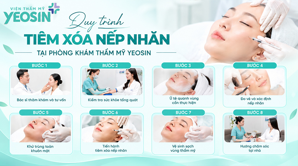 Quy trình tiêm xóa nếp nhăn ấn đường tại Yeosin